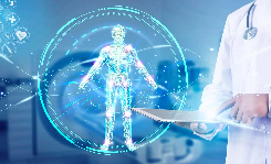 原发性肝癌诊疗指南2022版